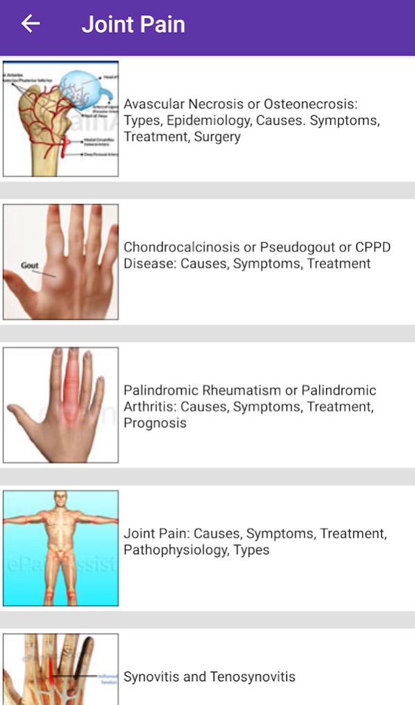 Symptoms of Osteoarthritis